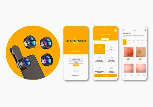 Design Awards Winner - AI MEDI SCAN - Accurate At-home Diagnosis of Skin Cancers